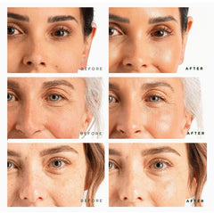 Tree of Life Facial Serum for Face, Brightening, Firming, Hydrating, Dry Skin, Dermatologist Tested - Trio Power Set