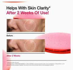 ANUA Niacinamide 10 + TXA 4 Serum, Hyaluronic Acid, Tranexamic acid, Vitamin B12, Facial Serum for Glass Skin, Clarifying, Radiant Complexion with Natural Color, Korean Skin Care (30ml