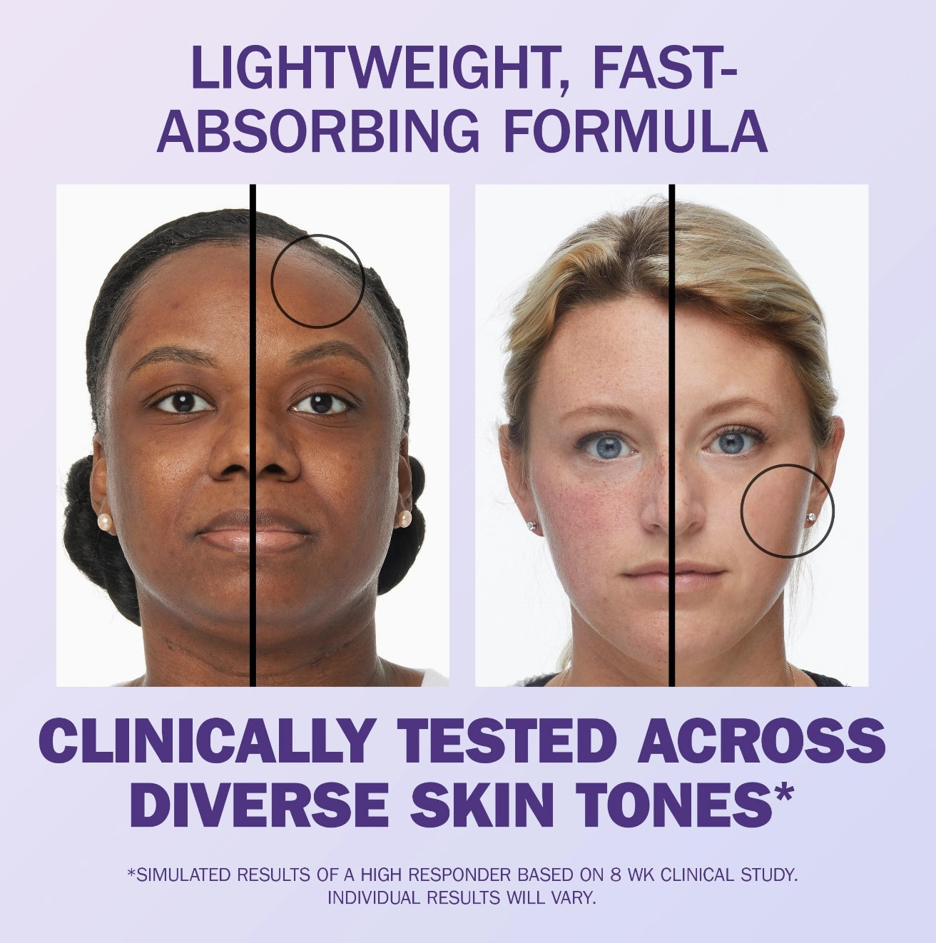 Olay Super Serum 50mL (1.7 oz) with Niacinamide, Vitamin C, Collagen Peptide, AHA, and Vitamin E Olay Super Serum 50mL (1.7 oz) with Niacinamide, Vitamin C, Collagen Peptide, AHA, and Vitamin E