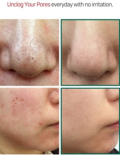 Sombymi - Aha.Bha.Pha 30Days Miracle Cleansing Bar Sombymi - Aha.Bha.Pha 30Days Miracle Cleansing Bar
