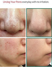 Load image into Gallery viewer, Sombymi - Aha.Bha.Pha 30Days Miracle Cleansing Bar