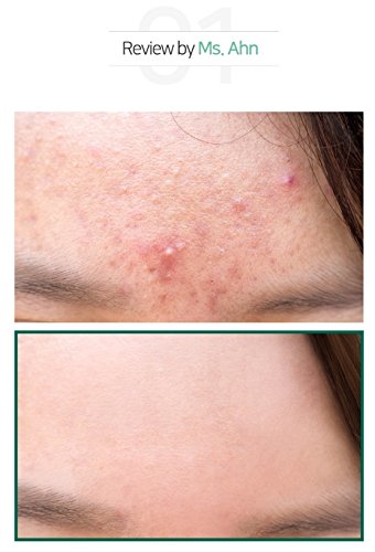 Sombymi - Aha.Bha.Pha 30Days Miracle Cleansing Bar Sombymi - Aha.Bha.Pha 30Days Miracle Cleansing Bar