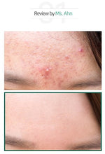 Load image into Gallery viewer, Sombymi - Aha.Bha.Pha 30Days Miracle Cleansing Bar