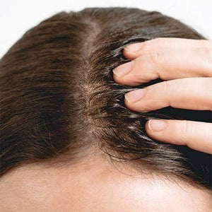 THE ORDINARY

Multi-Peptide Serum For Hair Density 60ml