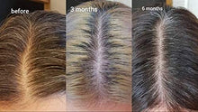 Load image into Gallery viewer, THE ORDINARY

Multi-Peptide Serum For Hair Density 60ml