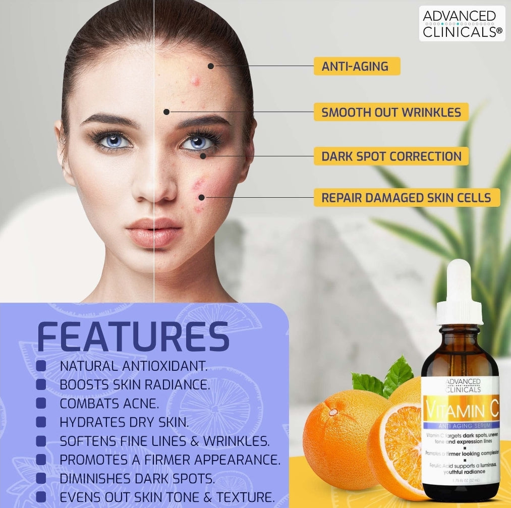 Advanced Clinicals Vitamin C Facial Serum Skin Care Anti-Aging Moisturizer Potent Vitamin C Face Lotion For Dry Skin, Age Spots, Wrinkle Repair, & Uneven Skin Tone, 1.75 Fl Oz