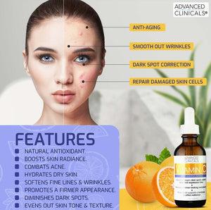 Advanced Clinicals Vitamin C Facial Serum Skin Care Anti-Aging Moisturizer Potent Vitamin C Face Lotion For Dry Skin, Age Spots, Wrinkle Repair, & Uneven Skin Tone, 1.75 Fl Oz