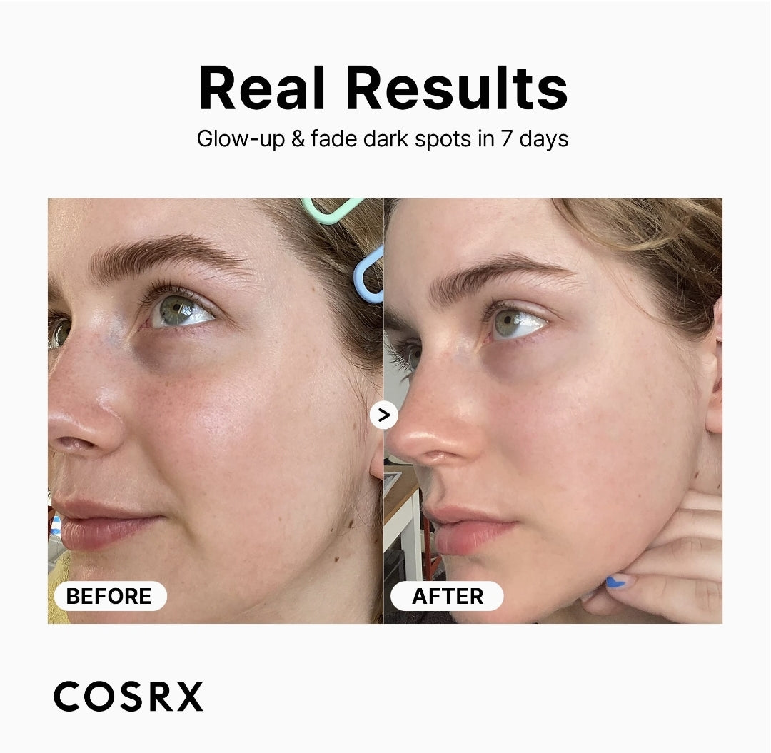 COSRX Vitamin C 23% Serum with Vitamin E & Hyaluronic Acid COSRX Vitamin C 23% Serum with Vitamin E & Hyaluronic Acid