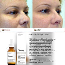 Load image into Gallery viewer, The Ordinary Caffeine Solution 5% + EGCG (30ml): Reduces Appearance of Eye Contour Pigmentation and Puffiness