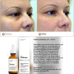 The Ordinary Caffeine Solution 5% + EGCG (30ml): Reduces Appearance of Eye Contour Pigmentation and Puffiness