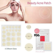 Load image into Gallery viewer, Cosrx, Acne Pimple Master Patch, 24 Patches